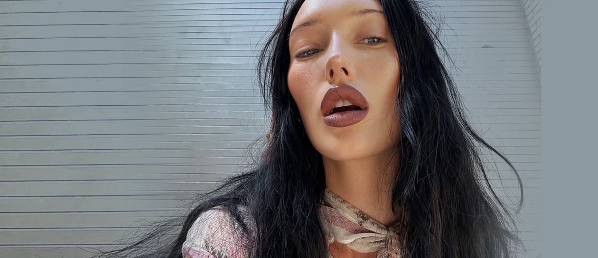 Η Gen Z κάνει αισθητικές επεμβάσεις και το καυχιέται